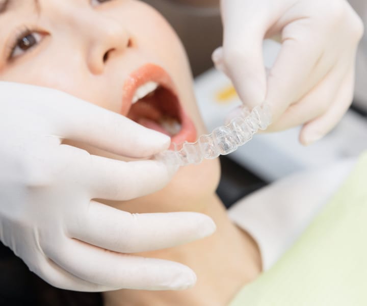 矯正歯科・マウスピース矯正